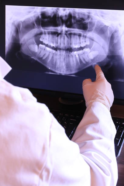 Best Broken or Chipped Tooth Repair in South Bloomfield, OH
