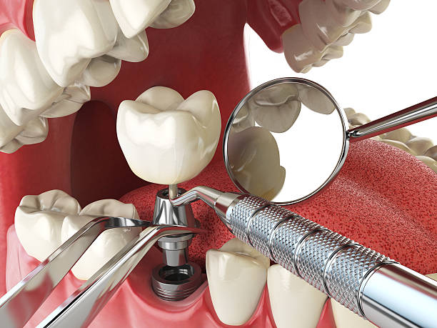 Best Weekend Emergency Dental Services in South Bloomfield, OH